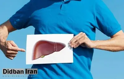 غذاهای مضر برای کبد چرب را بشناسید+اسامی