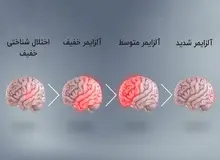 برای مقابله و پیشگیری از آلزایمر باید چه کارهایی را انجام دهیم و از چه مواد غذایی باید استفاده کنیم؟/ با ۹ ماده غذایی برای کاهش خطر ابتلا به بیماری آلزایمر آشنا شوید