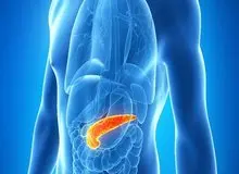 لوزالمعده در بدن مبتلایان به دیابت نوع یک، هورمون انسولین نمی‌سازد