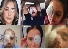 گزارشی از روند پرونده آسیب دیدگان چشم اعتراضات سال قبل در گفتگو با وکلای آنها: زخم اعتراض