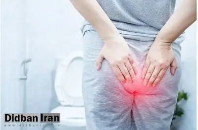 درد مقعد: علل، عوامل خطر و درمان ها