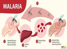 مالاریا تا چه مدت می‌تواند در بدن باقی بماند؟/ آیا ممکن است ماه‌ها یا حتی سال‌ها بعد بازگردد؟