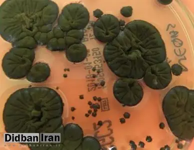 موجودی عجیب که خوراکش رادیواکتیو است! / هیولای چرنوبیل