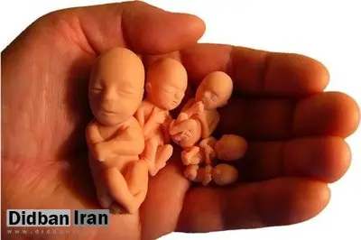چرا رتبه نخست سقط درمانی در کشور به خراسان رضوی تعلق دارد؟