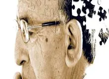 ۱۰نشانه‌ ابتلا به آلزایمر  را بشناسید 