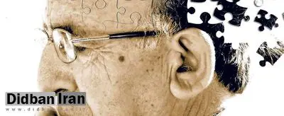 ۱۰نشانه ابتلا به آلزایمر را بشناسید