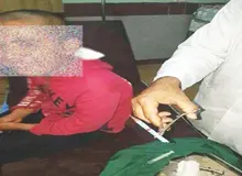 جزییات تنبیه یک دانش‌آموز در رودبار کرمان که انتشار عکسش با سر زخمی واکنش‌های زیادی را برانگیخت