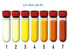 تغییر رنگ ادرار نشانه چیست؟
