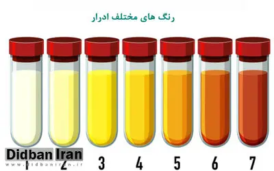 تغییر رنگ ادرار نشانه چیست؟