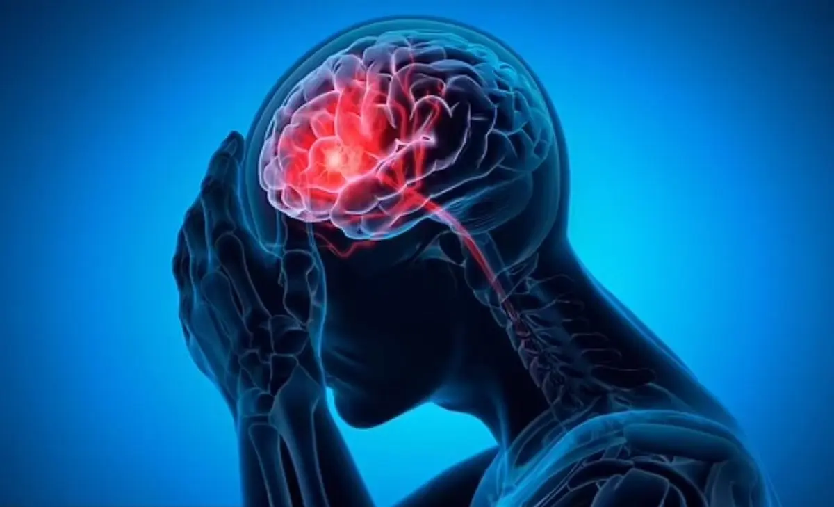 علائم هشدار سکته مغزی در ۹۰ روز آینده