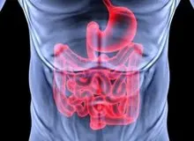 نرخ ابتلا به سرطان مقعد در دنیا افزایش یافته است