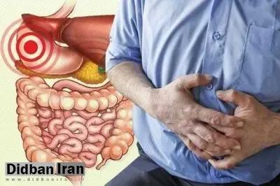 خوردن میوه با پوست یا بدون پوست؛ کدام بهتر است؟