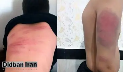 وزیر آموزش و پرورش: حالا بین یک میلیون معلم، یکی دست خودش نبوده و دانش آموزان را کتک زده، به گزینش ها ربطی ندارد