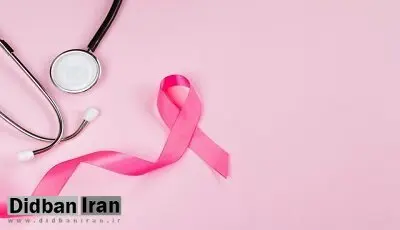 آدرس مراکز منتخب ماموگرافی رایگان از ۲۶ مهر تا ۳ آبان ۱۴۰۴
