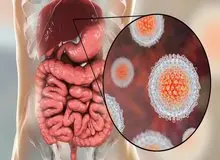 آمار مبتلایان به هپاتیت C در ایران اعلام شد