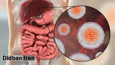 آمار مبتلایان به هپاتیت C در ایران اعلام شد