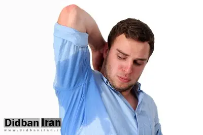 اگر زیاد عرق می کنید بخوانید