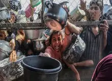 افزایش شمار جان باختگان سوءتغذیه در غزه به ۳۰۳ نفر