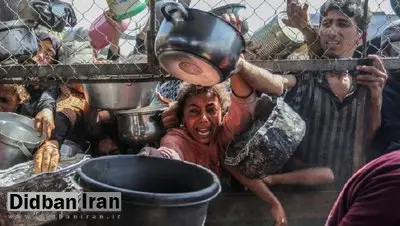افزایش شمار جان باختگان سوءتغذیه در غزه به ۳۰۳ نفر