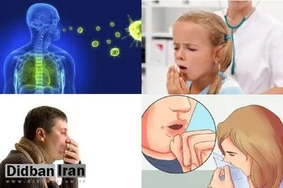 موارد ابتلا به سل در جهان به بالاترین حد خود رسیده است