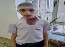 پرتاب تخته پاکن از سوی «معلم» سر دانش آموز را شکست 