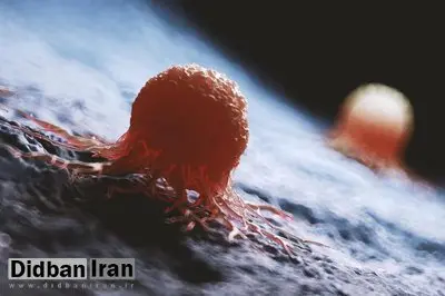 غذاهایی که خطر ابتلا به سرطان را افزایش می‌دهند