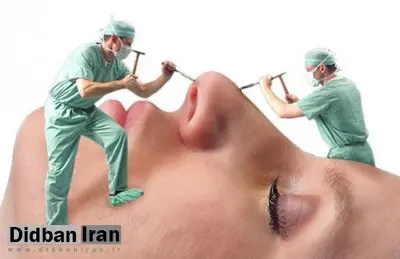 سن انجام عمل‌های زیبایی به زیر ۱۴ سال رسید