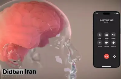 آزمایش تراشه جدید نورالینک از اکتبر آغاز میشود؛ تبدیل مستقیم افکار به متن