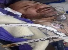 تصاویر هانی کرده در بیمارستان