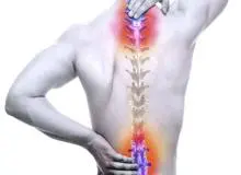 متخصص جراحی ستون فقرات در تهران