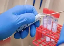 بیانیه دانشگاه علوم پزشکی جندی شاپور اهواز در خصوص مفقود شدن نمونه های تست کرونا