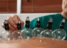 حجامت، روشی کارآمد جهت پاکسازی بدن!
