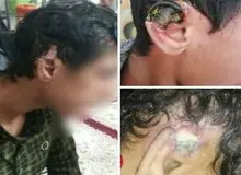 اقدام هولناک مربی کشتی در نقده علیه ۶ نوجوان/شکستن گوش نوجوانان و تزریق لیدوکایین+ عکس