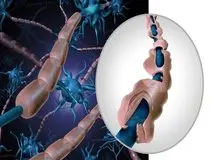 ابتلای ۱۲۰ هزار نفر به بیماری ام اس در کشور