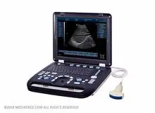 دستگاه سونوگرافی‌ای دزدیده شده بود پیدا شد