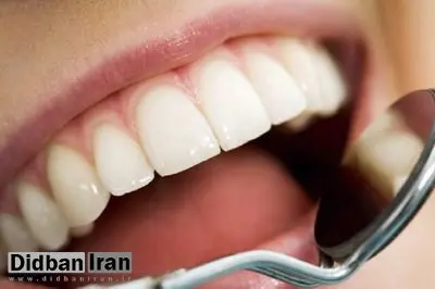راهکارهای پیشگیری از پوسیدگی دندان