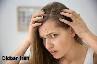 ۳ راه موثر برای جلوگیری از ریزش مو در زنان 