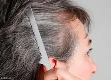 عوامل سفیدی زودرس موها چیست؟!