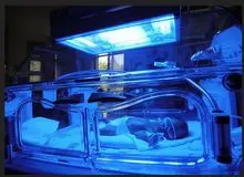 نکات بسیار مهم استفاده از دستگاه زردی نوزاد! + عکس دستگاه فتوتراپی