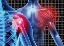 عوارض شکستن قولنج چیست؟