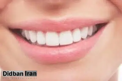 با ۵ راه طبیعی برای سفید کردن دندان‌ها آشنا شوید 