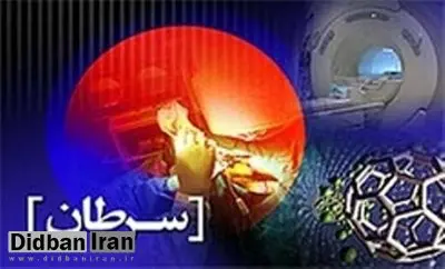 گیرکردن غذا هنگام بلع از نشانه‌های کدام سرطان است؟