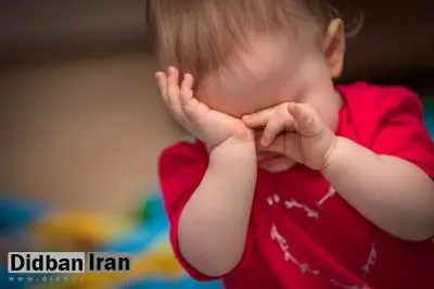 چرا نباید چشمهایمان را روی هم بمالیم؟