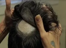 بازداشت ۹ نفر به خاطر کاشت مو و مژه زیرزمینی!