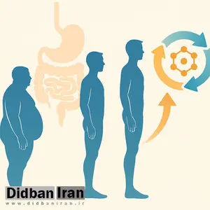 قبل از پرداخت هزینه بوتاکس معده در تهران، این مقاله را بخوانید!