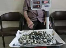 جوان ۲۰ ساله دو کیلوگرم مواد مخدر را در شکم خود جاسازی کرد+تصویر