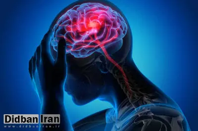 کاهش خطر سکته مغزی با مصرف این ویتامینها