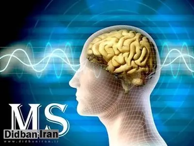 تایید دارویی جدید برای بیماران مبتلا به MS