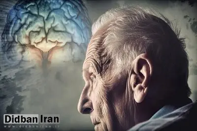 تشخیص زودهنگام آلزایمر از پشت فرمان خودرو!