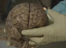 علم چه می‌گوید؛ آیا ما فقط از ۱۰ درصد توان مغز خود استفاده می‌کنیم؟